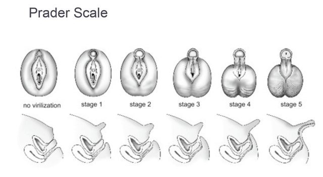 penis și pubertate cu un penis proeminent